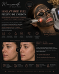 Hollywood Peel( carbón peel)