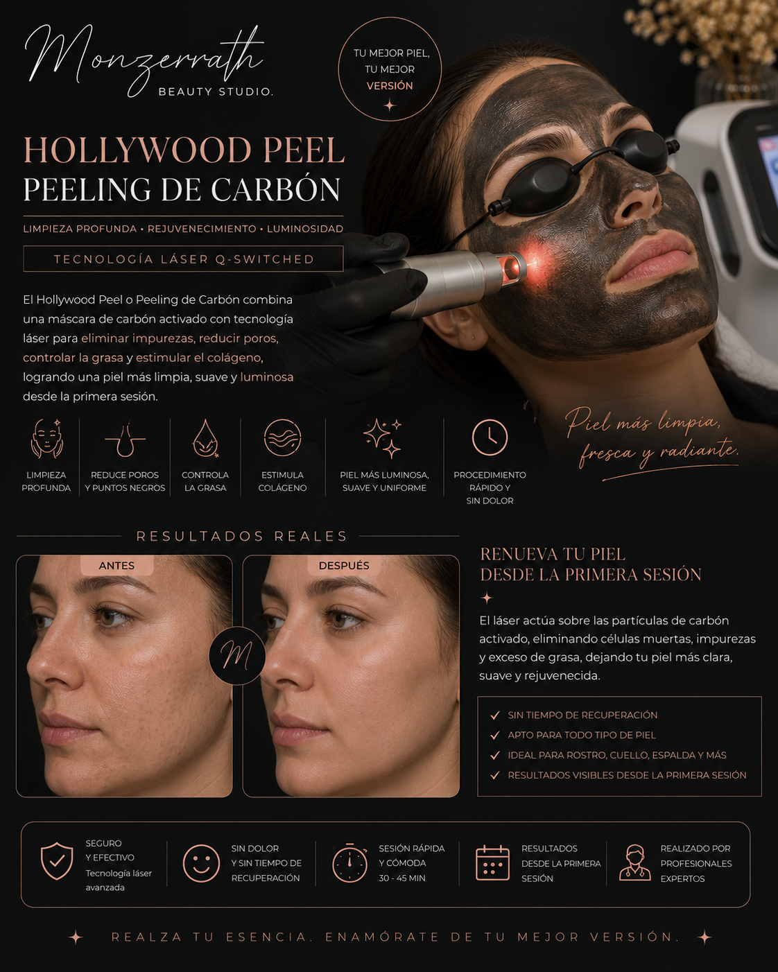 Hollywood Peel( carbón peel)