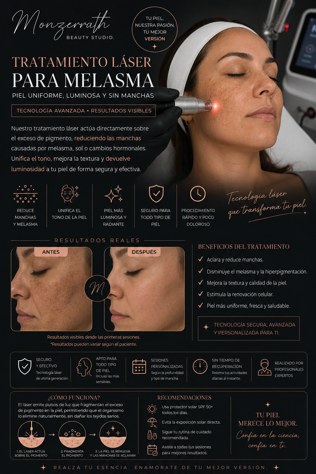 Manchas de Melasma